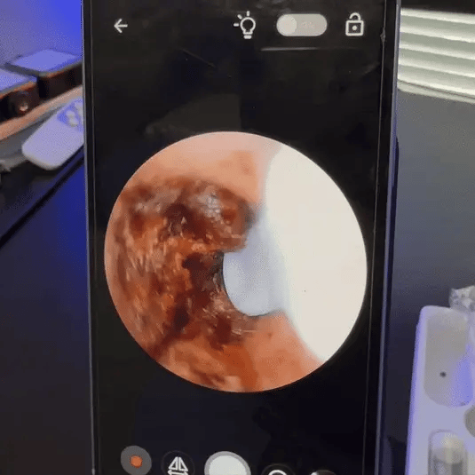 WaxFree™ – Inteligentne czyszczenie uszu