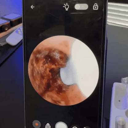 WaxFree™ – Inteligentne czyszczenie uszu